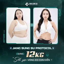 dau-tu-voc-dang-jang-sung-su-protocol.jpg